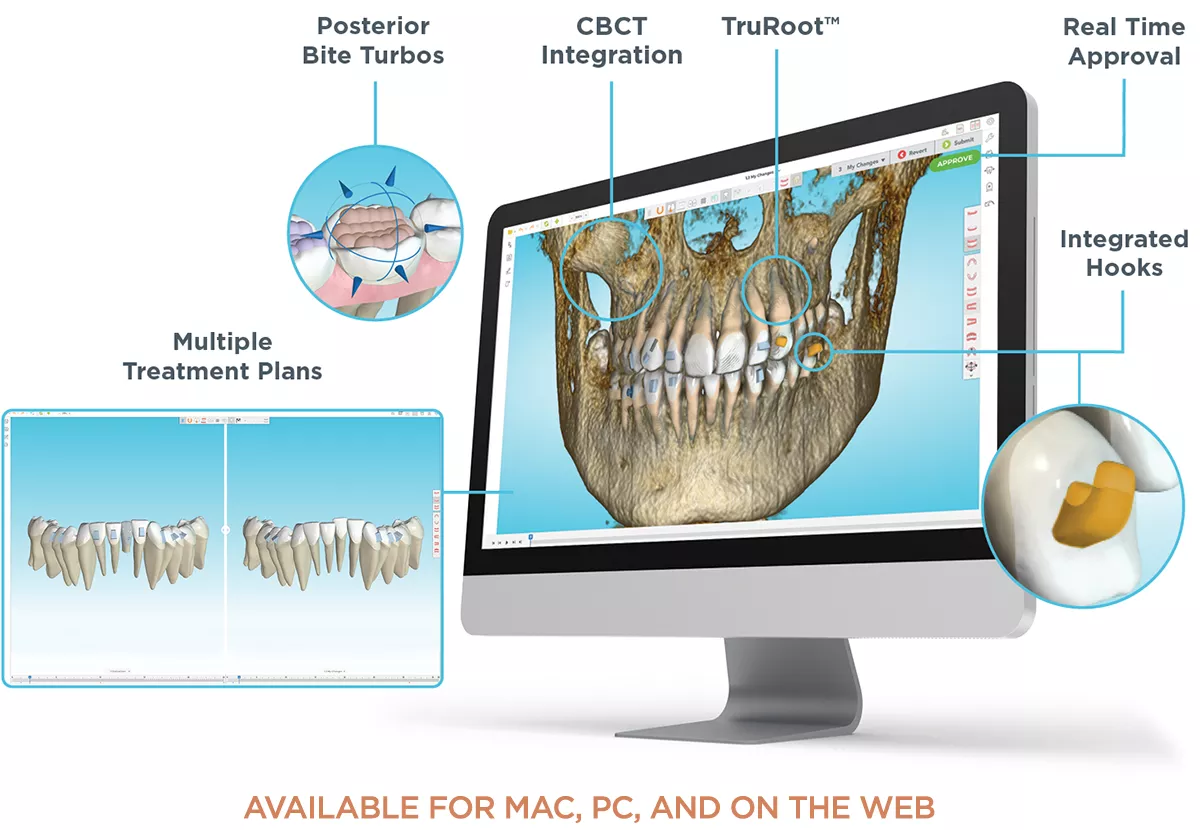 Spark Clear Aligners | Doctor Site - Innovative & Advanced